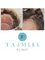 Tajmeel Clinic- Bournemouth, UK - Hair transplant results  6 monts  