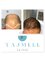 Tajmeel Clinic- Bournemouth, UK - hair transplant results at 5 months  