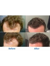 Better Hair Transplant Clinics - Essex - Brentwood,  0