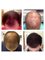 Better Hair Transplant Clinics - Portsmouth - Portsmouth Technopole, Kingston Crescent, Portsmouth, PO2 8FA,  0