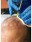 Surgery Group Ltd Ealing - Surgery Group - Hair Regrowth Injection (HRI) Treatment  