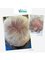 Newcastle Hair Transplants Clinics - 116 Quayside, Newcastle Upton Tyne, NE1 3DY,  5