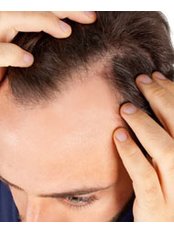 Natural Treatment for Alopecia /Hair Loss - New Man Clinic