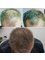 Better Hair Transplant Clinics - Coventry - 4 Queen Victoria Road, Coventry, CV1 3JH,  5