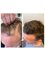 Leeds Hair Loss Clinic - Turnberry Park Road, Pure Offices, Morley, Leeds, LS27 7LE,  15