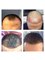 Better Hair Transplant Clinics - Leeds - Princes Exchange, Princes Square, Leeds, LS1 4HY,  1