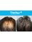 The Hair Dr - Crown 3500 FUE grafts 