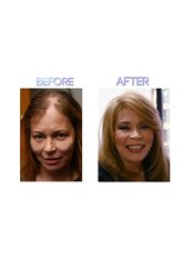Hair Loss Specialist Consultation - Clara Alexander Clinic