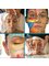 Catherine Clooney Facial Reflexology - Facial Reflexology 