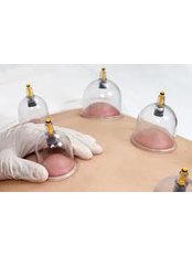 Hijama on back only  - Miracles of Hijama Cupping Therapy MHT Ireland