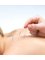 Carahealth Acupuncture Naturopathy Homeopathy - Acupuncture increase serotonin and endorphins to promote well-being and alleviate pain. Carina is a degree qualified Acupuncturist 
