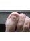 Biomedical Clinics - fungal toes before 