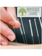 Acupuncture Treatment - Riverside Natural Health Centre