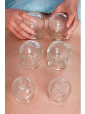 Cupping - Harmony Acutherapy Clinic