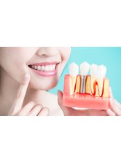 Dental Implants - Mediland