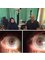 Shalash LASIK & Eye Care Clinics - Mrs Sadeya 6 months after her successful keratoplasty 