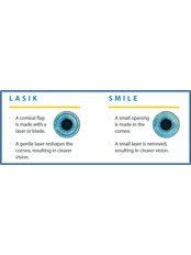 SMILE Eye Surgery - Mahajan Eye Centre