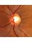 Jain Eye Clinic Hospital - (Unit M.R.J. Institute of Ophthalmology & Satya Mohan Laser Centre), K-4-A, Fatehtiba, Moti Doongri Road, Adarsh Nagar.Opp. Shanker Mistan Bhandar, Jaipur, RAJASTHAN, 302004,  4
