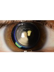 Lens Replacement Surgery (Trifocal Lens) - Dr. Emir Doğan - Laser Eye Surgery