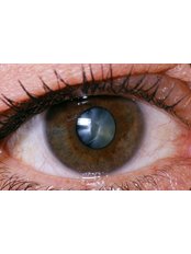 Cataract Surgery (Monofocal Lens) - Dr. Emir Doğan - Laser Eye Surgery