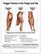 Trigger Point Therapy - Energise Therapy,Sports Injury and Shockwave Therapy Clinic