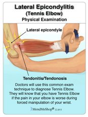 Tennis Elbow - Energise Therapy,Sports Injury and Shockwave Therapy Clinic