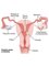 Zenovi Gynaecology Clinic and Fertility Center - female genital system 