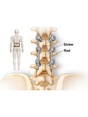 Spinal Fusion - Spine Care & Ortho Care
