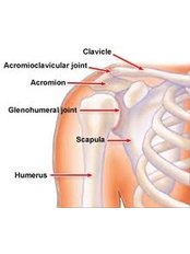 Shoulder Replacement - Isomer