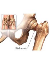 Joint Replacement Surgery - KIMS - Orthopaedic Hospital India