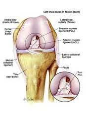 Knee Reconstructive Surgery - KIMS - Orthopaedic Hospital India