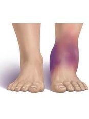 Ankle Injury Treatment - KIMS - Orthopaedic Hospital India