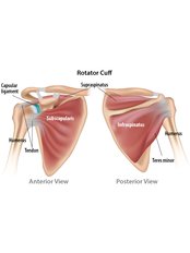 Rotator Cuff Repair - Orthopaedic Clinic