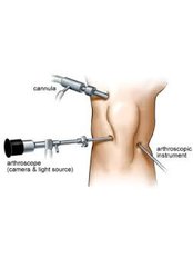 Knee Arthroscopic Washout - Providence Orthopaedics