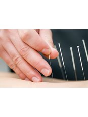 Acupuncturist Consultation - Elite Spine Clinic