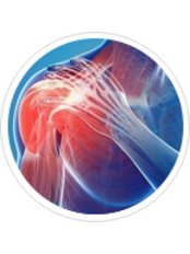 Shoulder Rehabilitation - APRC Physiotherapy Greater Noida