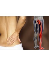 Sciatica Treatment - Physiotherapy Clinic - Hyderabad , Ameerpet