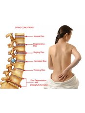Spinal Rehabilitation - Neck and Back Injury - Clare O' Grady MISCP