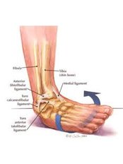 Ankle Injury Treatment - Clare O' Grady MISCP