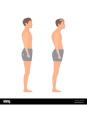 Posture Management - CURE PHYSIO PETALING JAYA