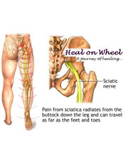 Sciatica Treatment - Heal on Wheel