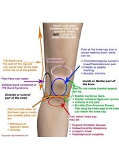 Knee Rehabilitation - EC Mobile Physiotherapy