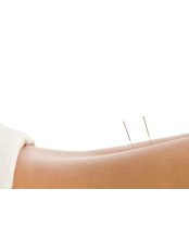 Acupuncturist Consultation - St Judes Physiotherapy Clinic