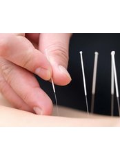 Acupuncturist Consultation - Advance Physiotherapy & Sports Injury Clinic