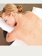 Imagine Physiotherapy Clinics - Sedgefield - Acupuncture