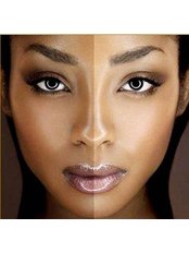 Skin Lightening - Free-Line Health and Beauty Therapy Home