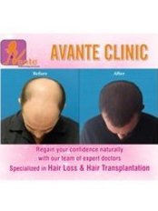 Avante - Hair Loss Clinic in India