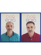 ENTO Medical Center - Haarklinik in der Türkei