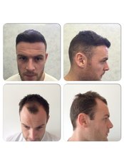 KSL HAIR CLINIC MAIDSTONE - Hair Loss Clinic in the UK
