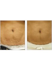 Better Body Surgery - Manchester - Plastic Surgery Clinic in the UK
